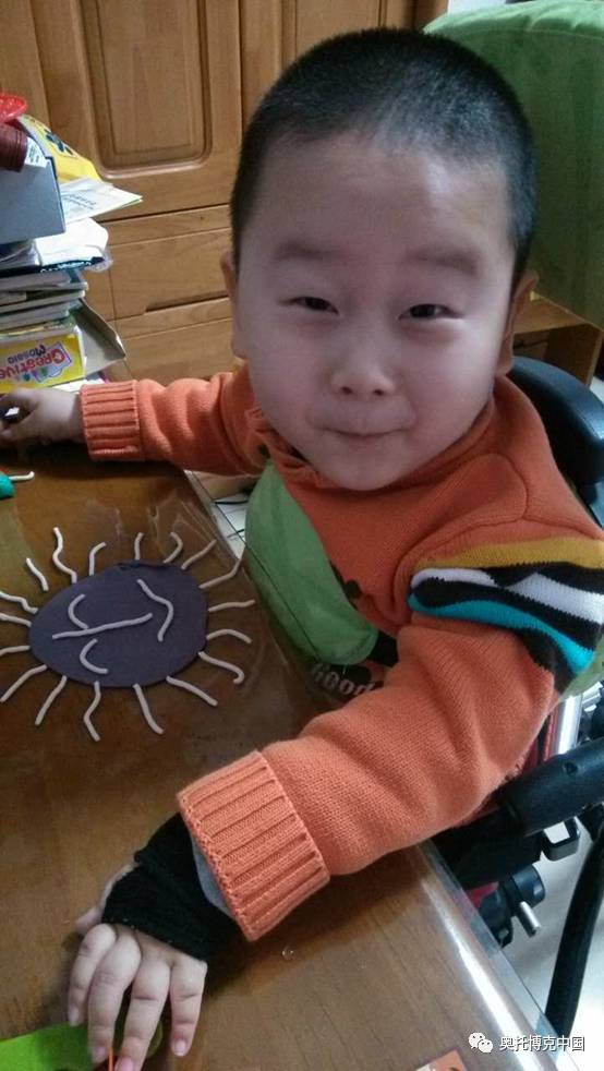 奥托博克假肢 奥托博克假肢