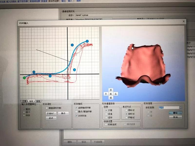 小腿假肢 小腿假肢