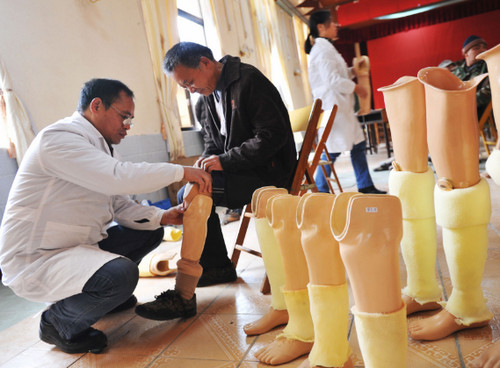 假肢矫形器 假肢矫形器