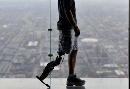 下肢假肢 下肢假肢