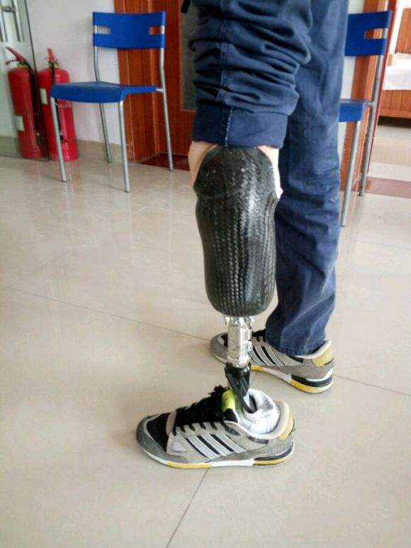 小腿假肢 小腿假肢